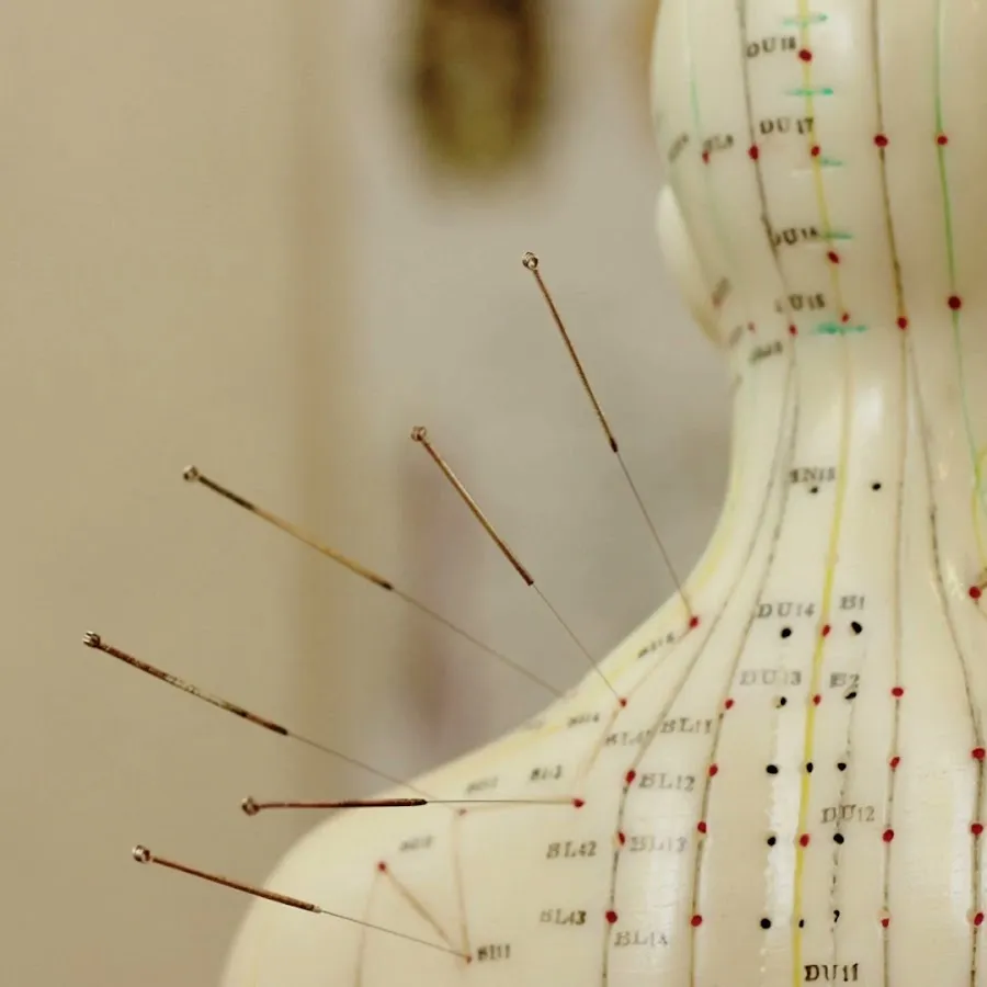 Acupuncture Holistic Healthplus photo 2