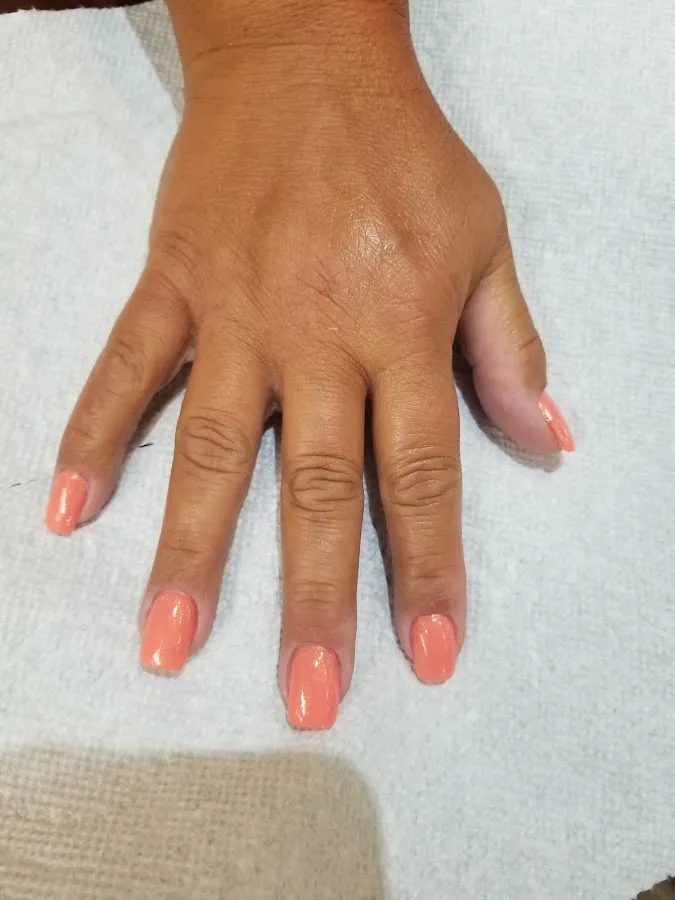 Anthony's Wild Hairs