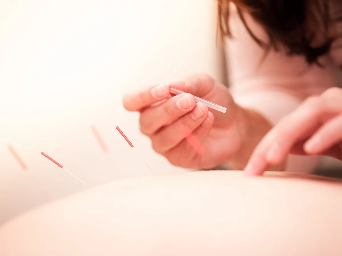 Benevolent Acupuncture and Wellness Center photo 4