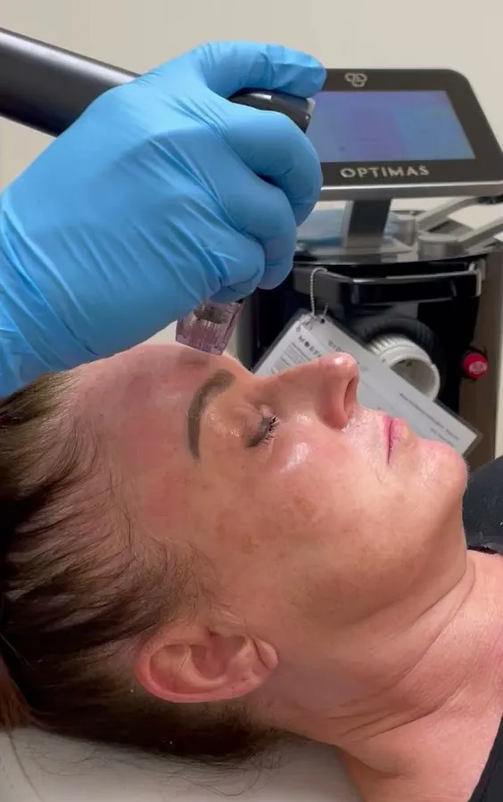 Cherry Hill Med Spa photo 4