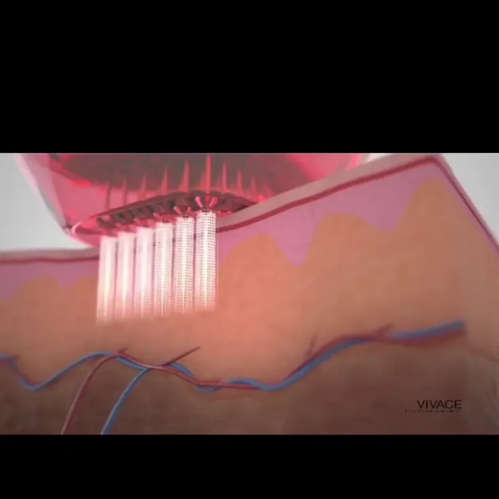 Dr. Amy Krachman/ Dermalogic Laser Center photo 4