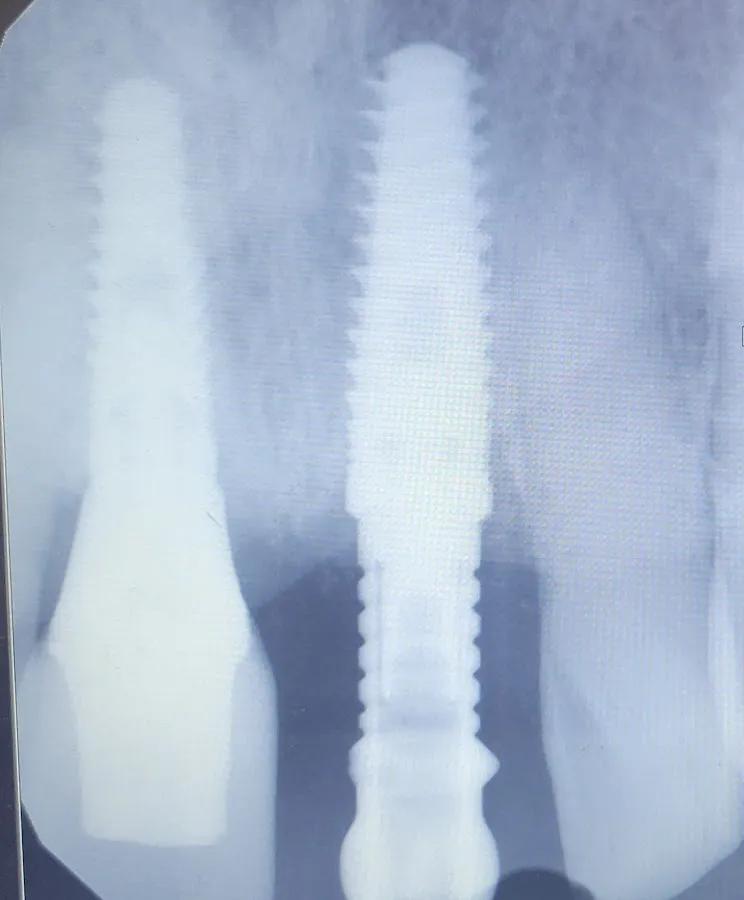 Dr. Thomas Torre DMD {Family, Cosmetic and Implant Dentistry } photo 3