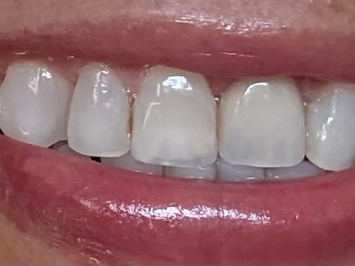 Emergency Dentist 24/7 Margate photo 4