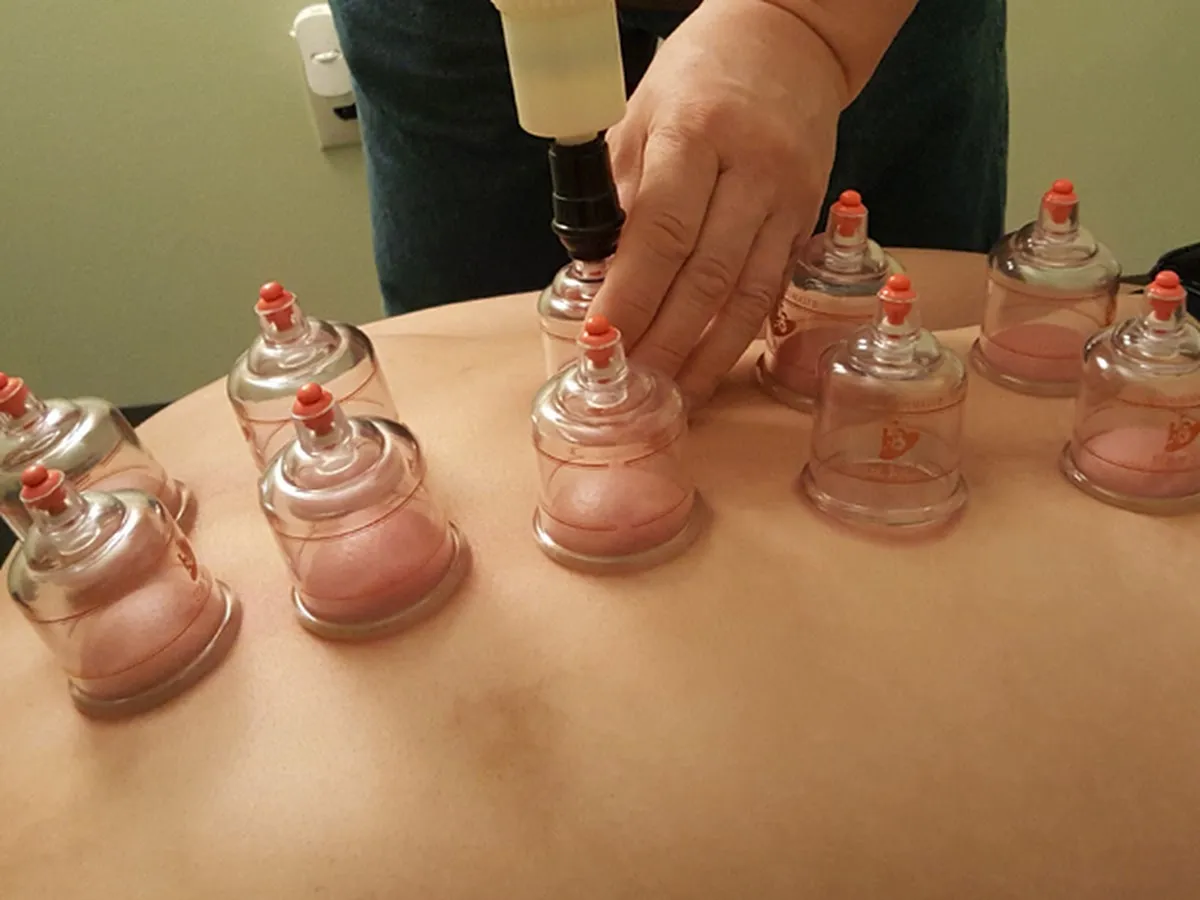 Living Well Acupuncture photo 4