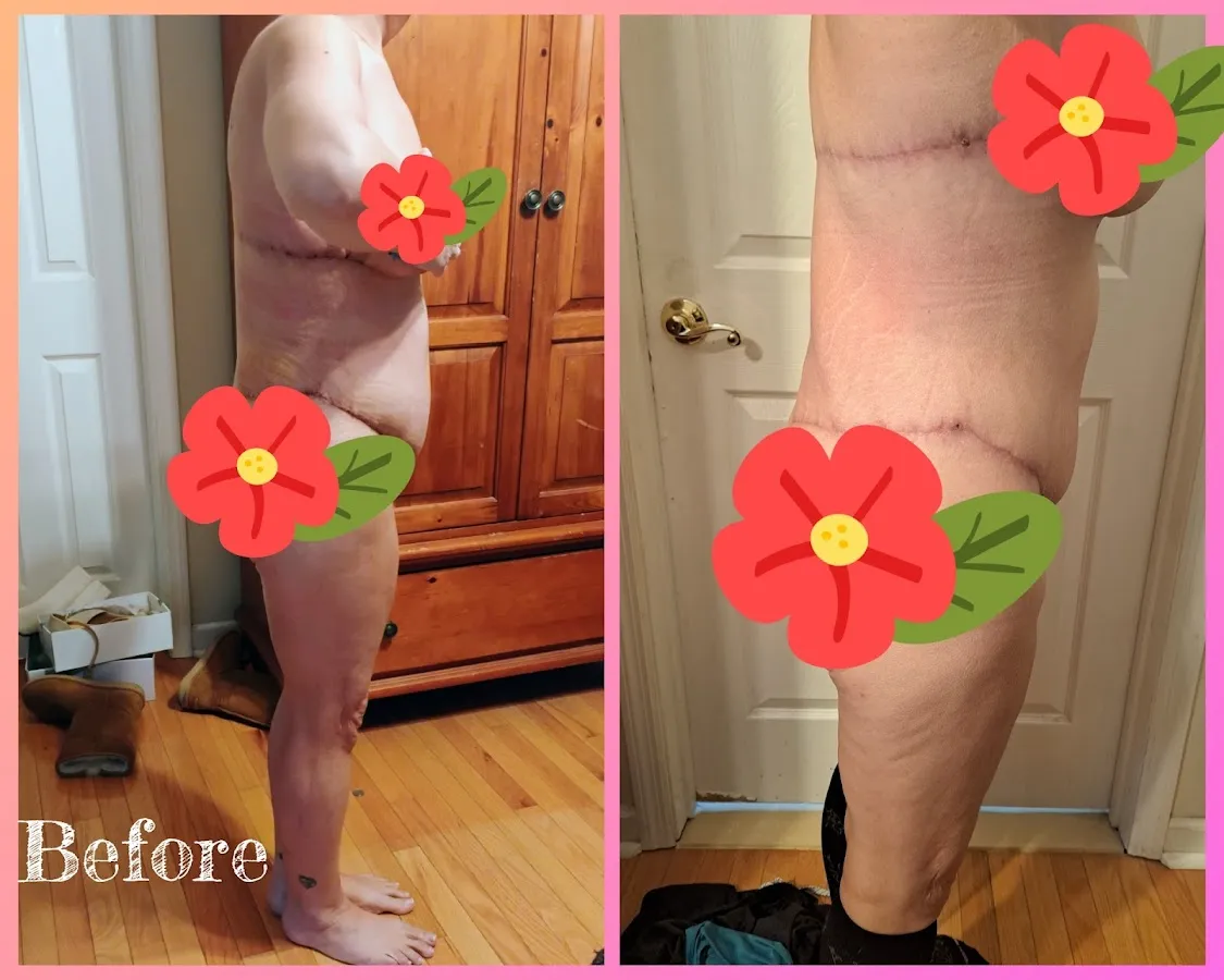 Perfectly Imperfect Massage Post Operative Certified, Lymphatic Trained Mobile Services Provider photo 3