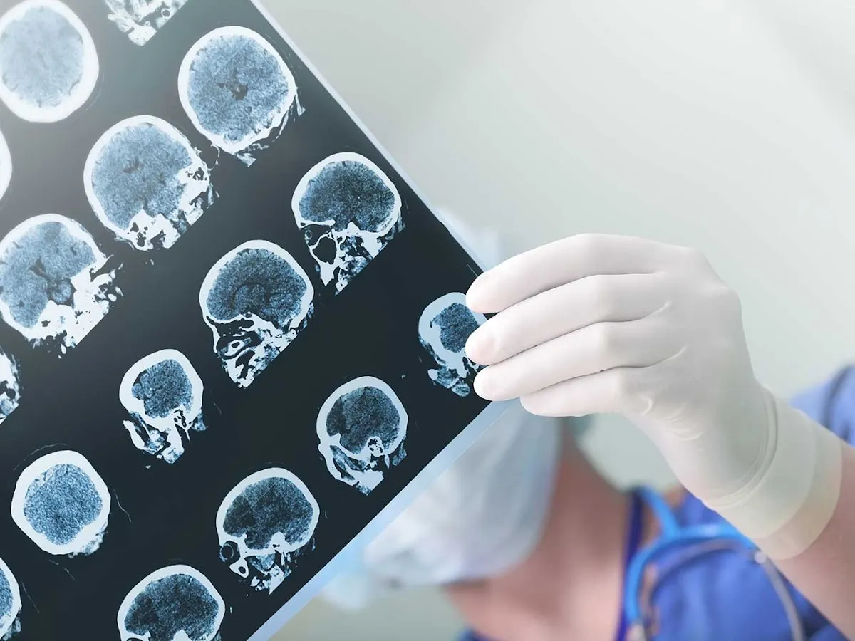 Pluese Becker Saltzman LLC photo 4