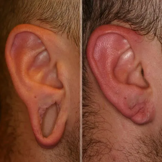 Ringpfeil Advanced Dermatology photo 2