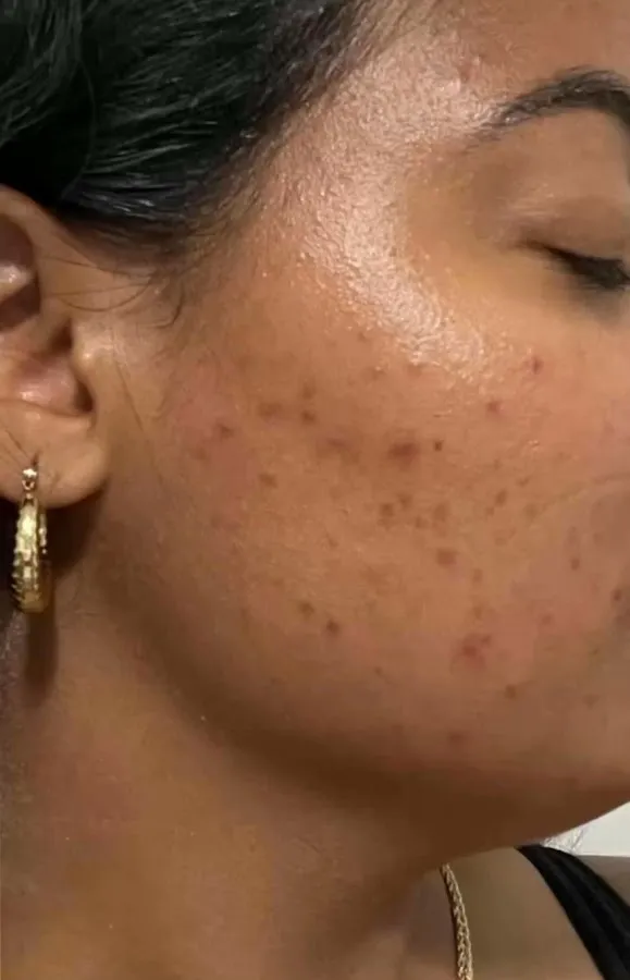 Skin Age Rejuvenation Spa photo 4