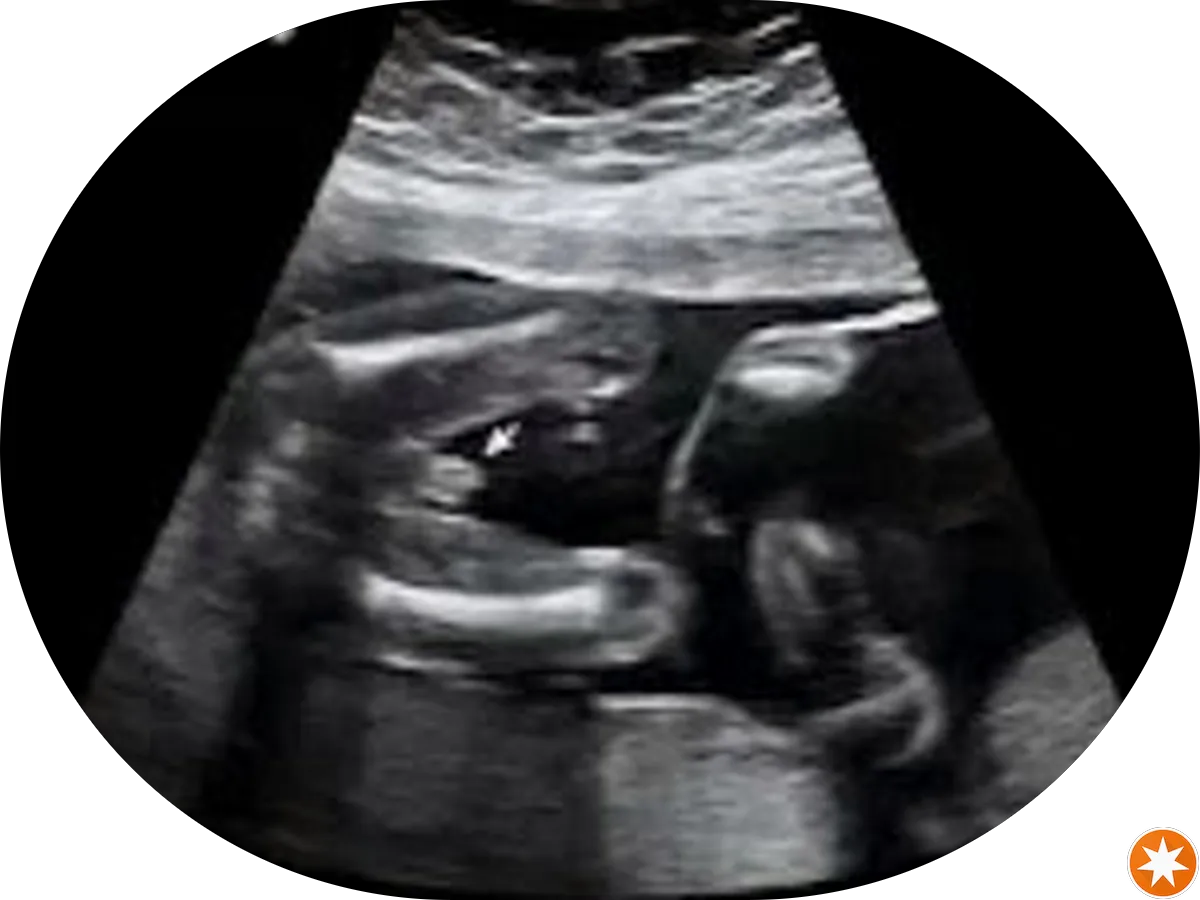 The Art of Living - Princeton, Yoga And Meditation Studio photo 2