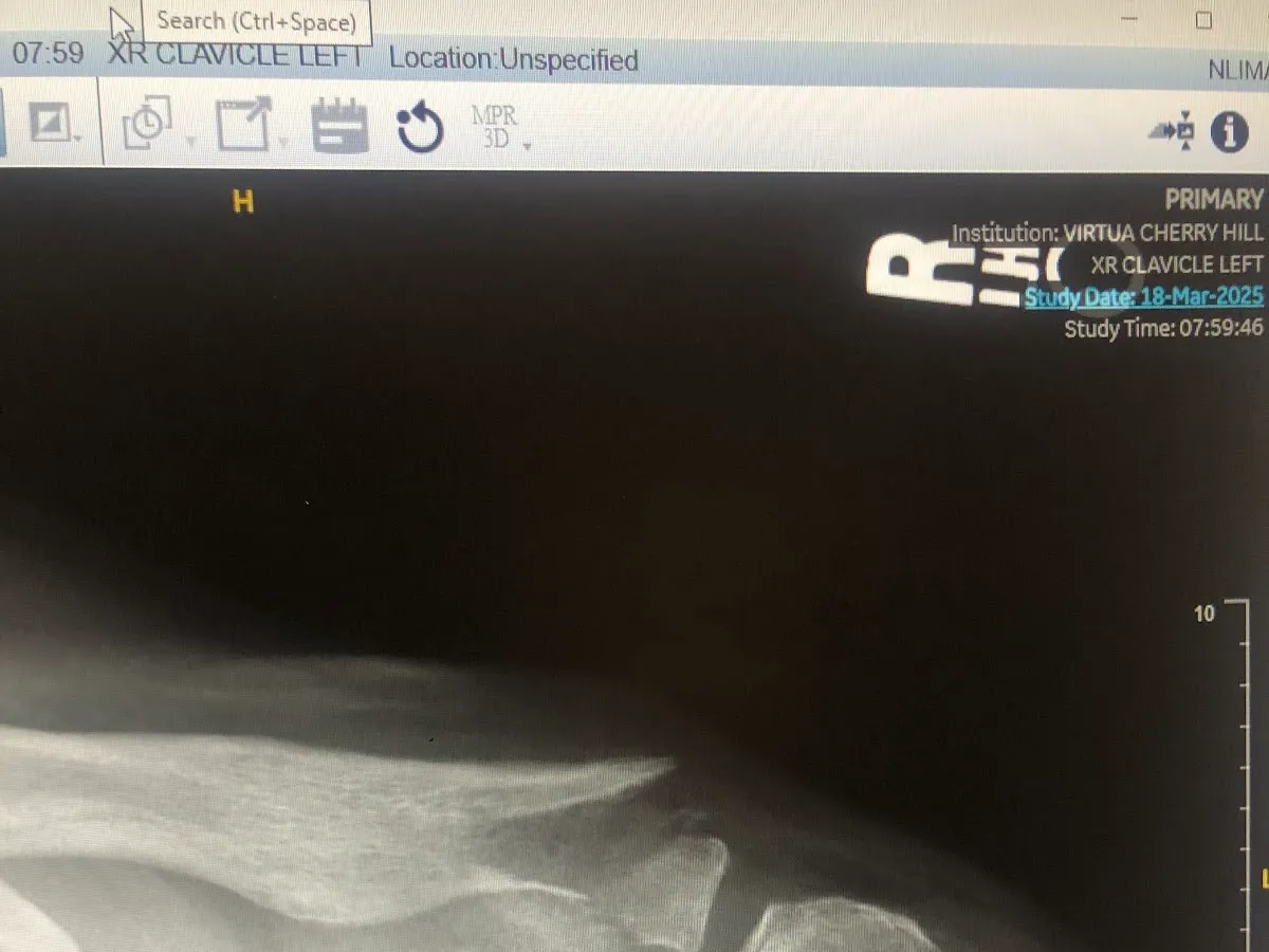 Virtua Reconstructive Orthopedics - Cherry Hill